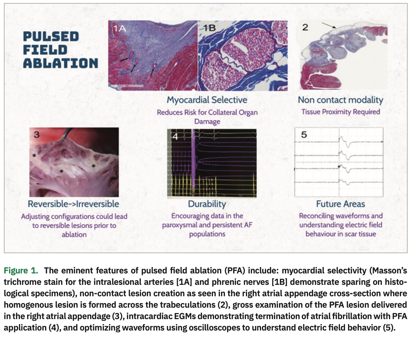 The Promise of Pulsed Field Ablation An Update